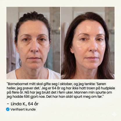 Koreansk Silke-Kollagenampulle